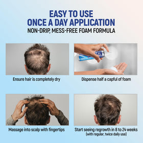 TARO Minoxidil 5% Foam back view with ingredient list