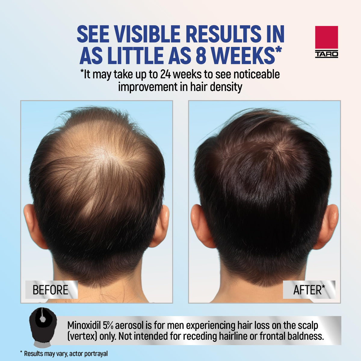 TARO Minoxidil for Men 5% 2.11 Oz side view
