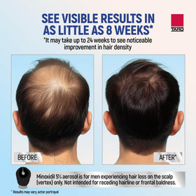 TARO Minoxidil for Men 5% 2.11 Oz side view