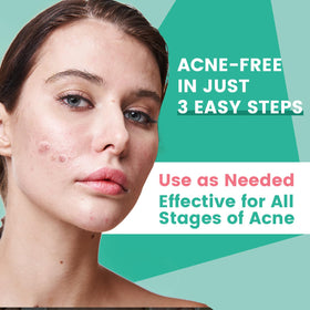 TEAWOO 3-Step Microdart Pimple Patches Set on a bathroom counter