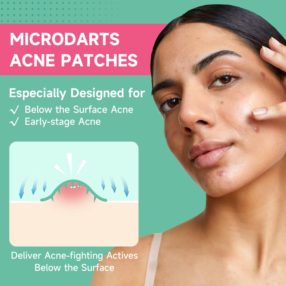 TEAWOO Microdart Acne Patches packaging side view