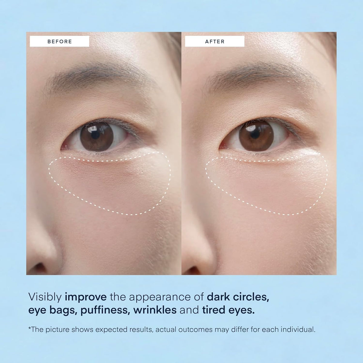 TEREZ & HONOR Under Eye Patches with ingredients displayed