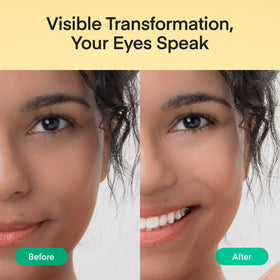 TEREZ & HONOR Vitamin C Niacinamide Eye Patches with ingredients displayed
