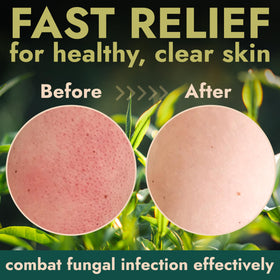 Terramed Antifungal Body Scrub with tea tree oil ingredients