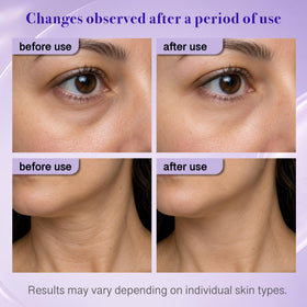 Tetea Neck Cream applied on skin for hydration