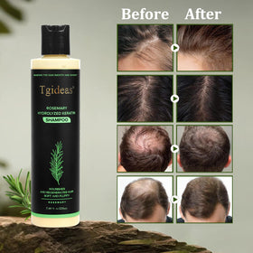 Tgideas Rosemary Biotin Shampoo 2-Pack side view