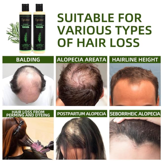 Tgideas Rosemary Biotin Shampoo in bathroom setting