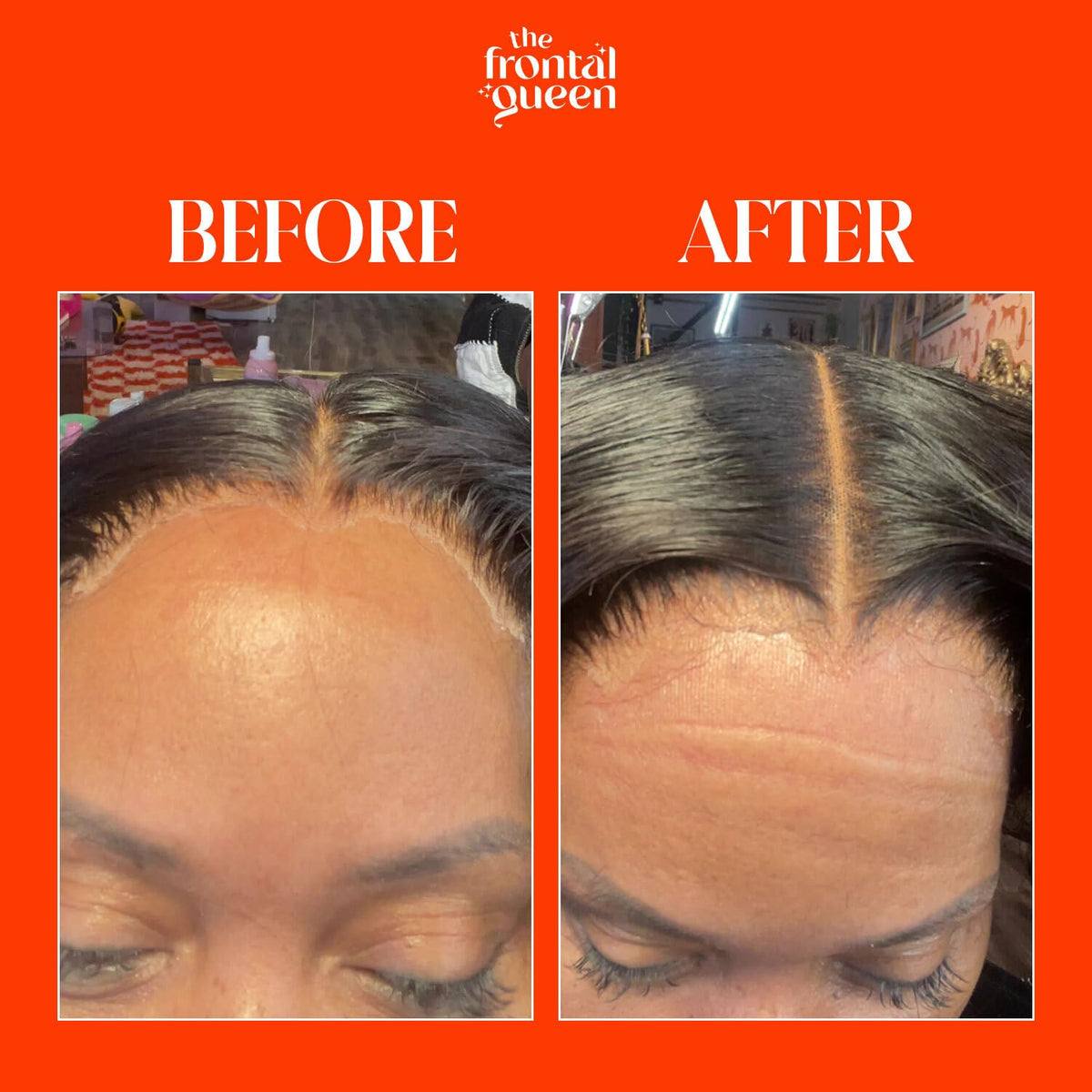 The Frontal Queen Lace Melting Spray application on lace wig