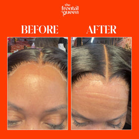 The Frontal Queen Lace Melting Spray application on lace wig