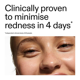 The INKEY List Azelaic Acid Serum packaging