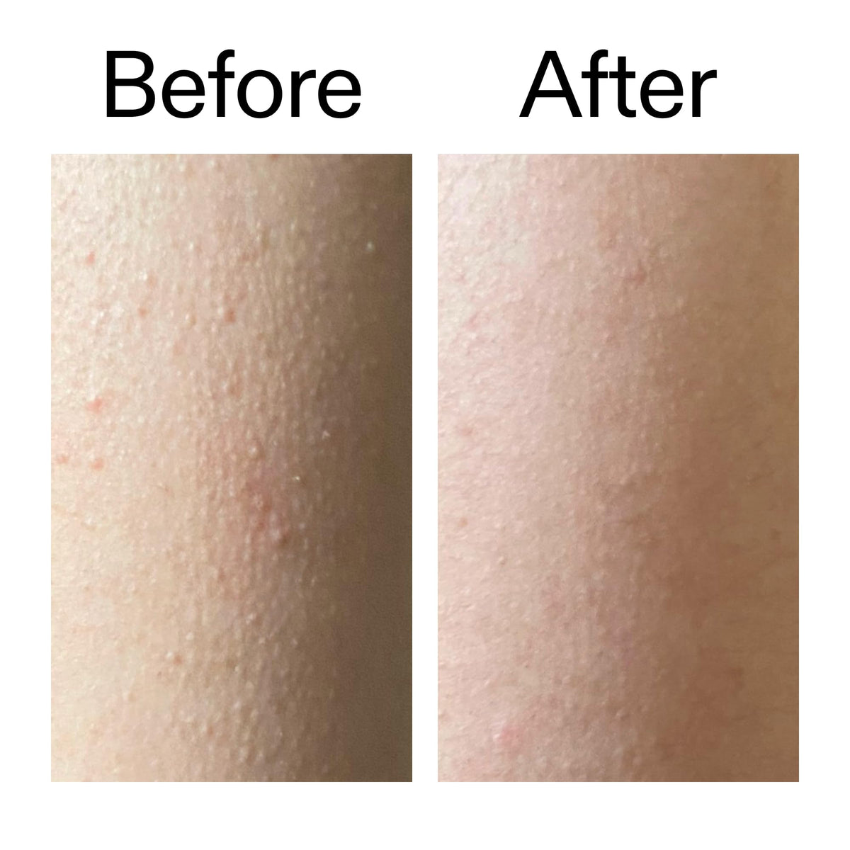 The INKEY List Glycolic Acid Exfoliating Body Stick lifestyle shot