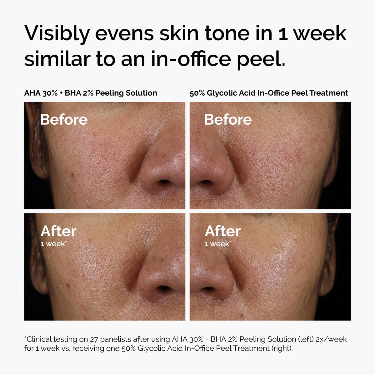The Ordinary AHA 30% + BHA 2% Peeling Solution with skincare products