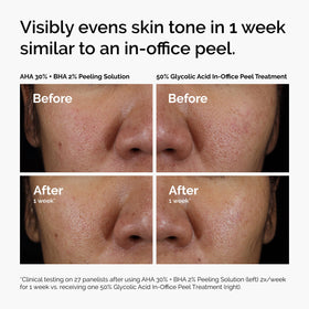 The Ordinary AHA 30% + BHA 2% Peeling Solution with skincare products
