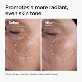 The Ordinary Glycolic Acid 7% Exfoliating Toner bottle with cap
