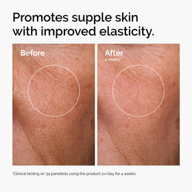 The Ordinary Hyaluronic Acid 2% + B5 Serum packaging