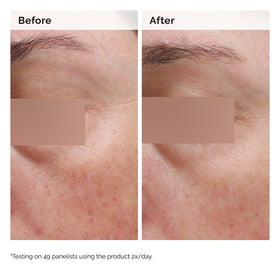 The Ordinary Niacinamide 5% Emulsion in skincare routine setup