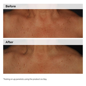 The Ordinary Niacinamide 5% Face and Body Emulsion with ingredients list