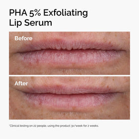 The Ordinary PHA 5% Exfoliating Lip Serum showing product texture
