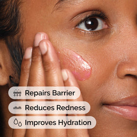 The Ordinary Soothing & Barrier Support Serum application on skin