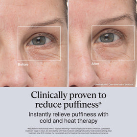 TheraFace Depuffing Wand in use on under-eye area