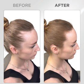 Thick Fiber Root Touch Up Powder application on hairline
