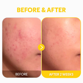 TIRTIR Pure Vitamin C 24% Face Serum lifestyle scene