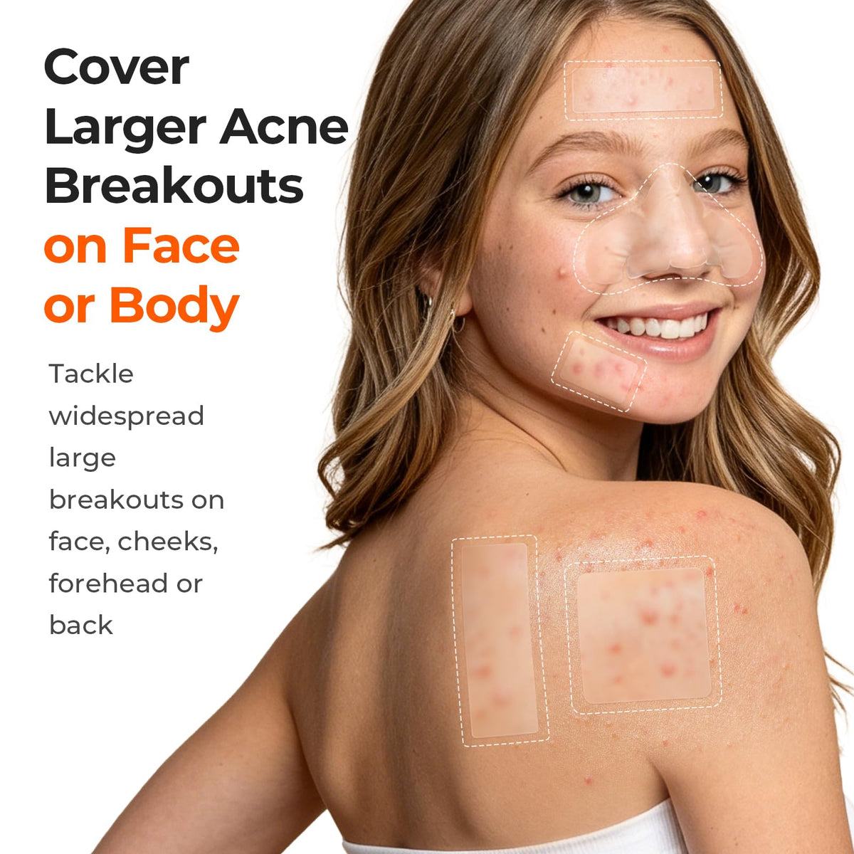 TKTK Large Hydrocolloid Pimple Patches showing various sizes