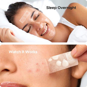 TKTK Large Pimple Patches assortment of sizes
