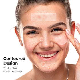 TKTK Large Pimple Patches on a skin surface