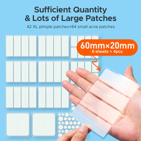 TKTK Large Pimple Patches showing various sizes