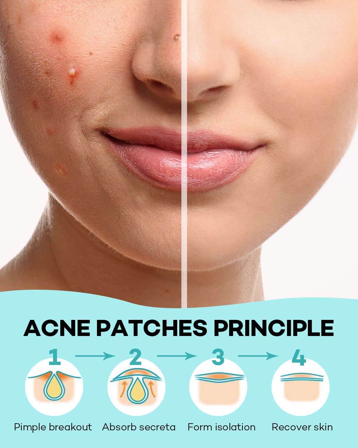 TKTK Pimple Patch packaging back view with instructions