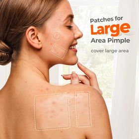 TKTK XL hydrocolloid patch on skin