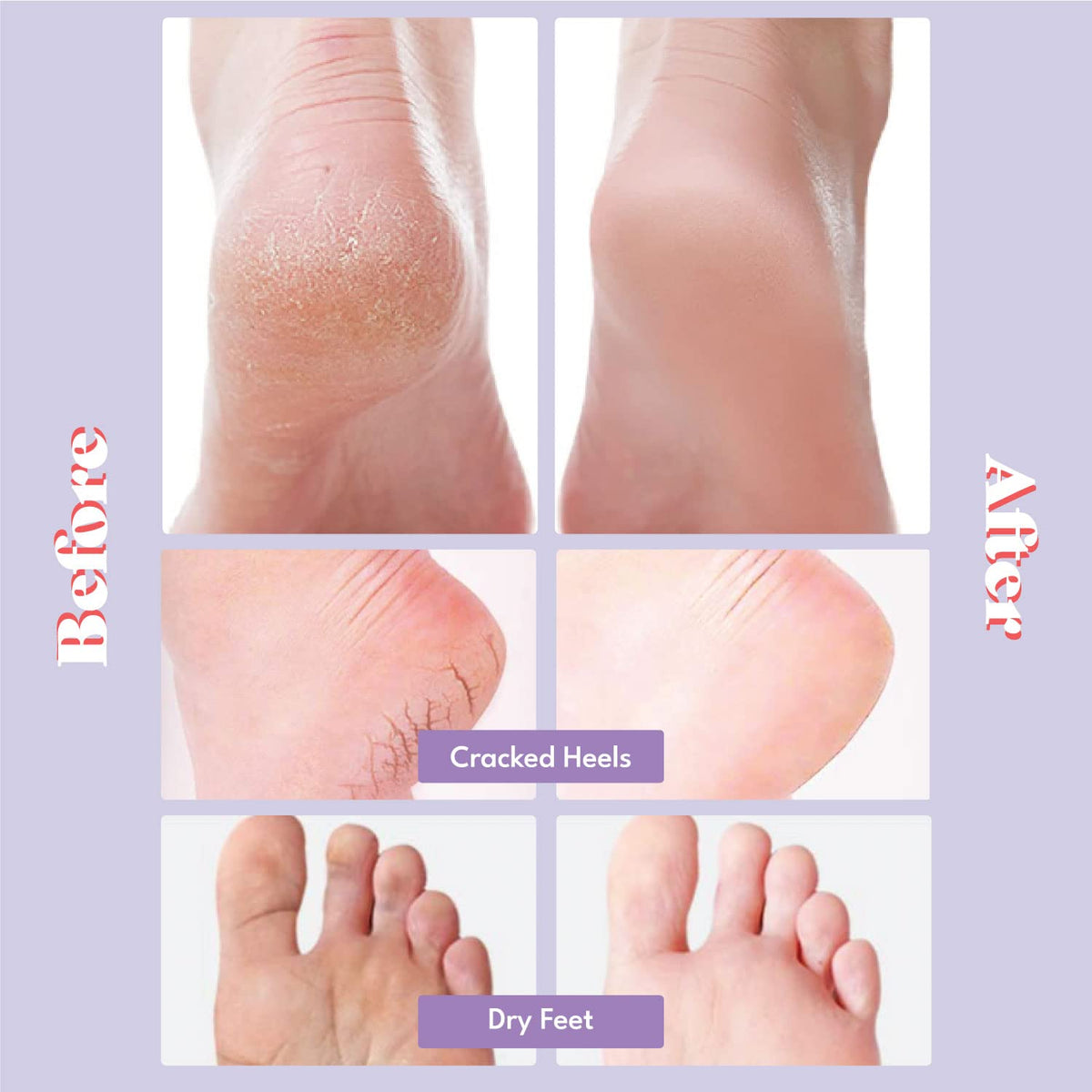 TOI:L Extra Silky Foot Mask with Guerande Salt and Sweet Almond Oil