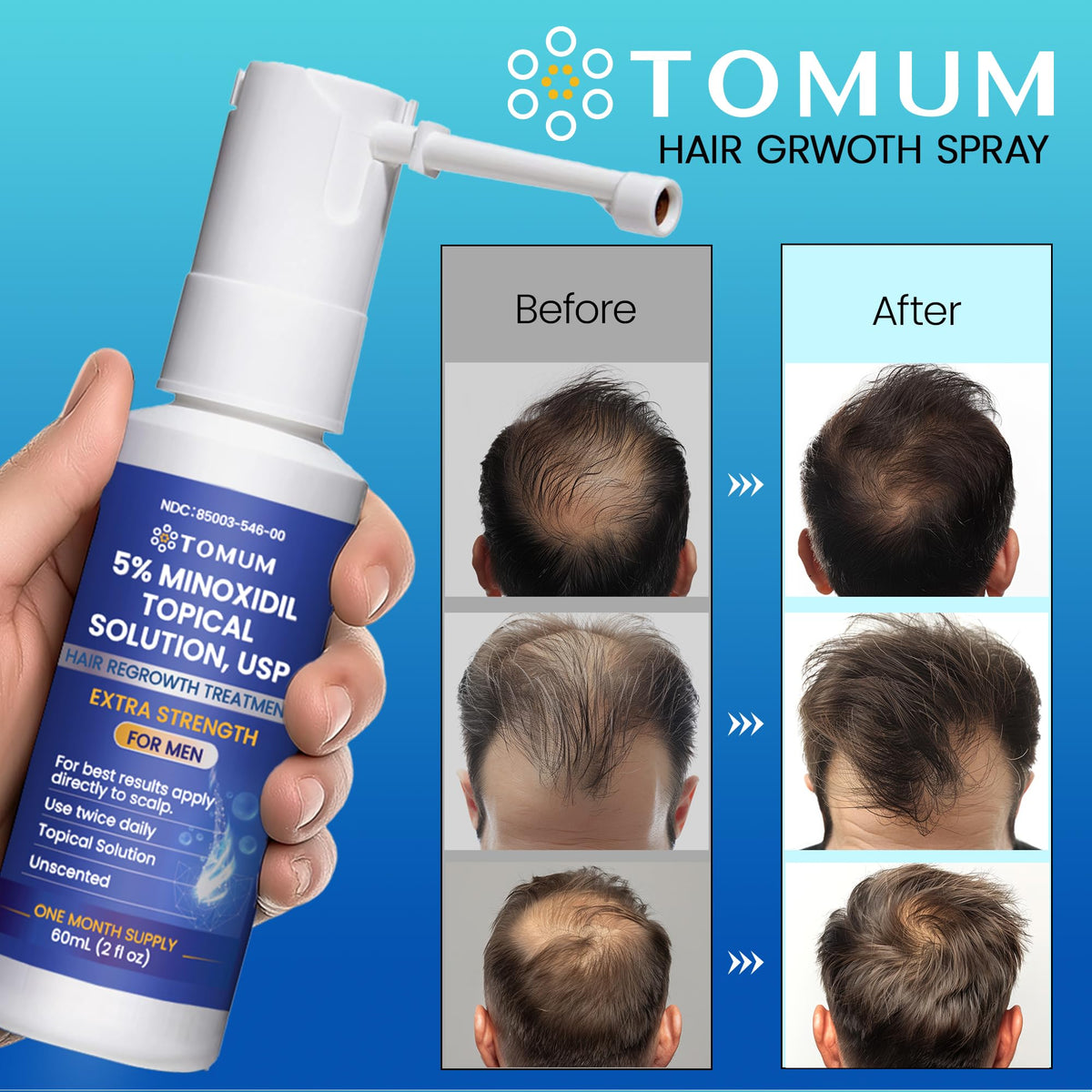 TOMUM Men's Hair Growth Spray 5% Minoxidil packaging