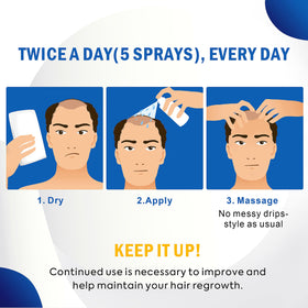 TOMUM Minoxidil 5% Hair Regrowth application on hair