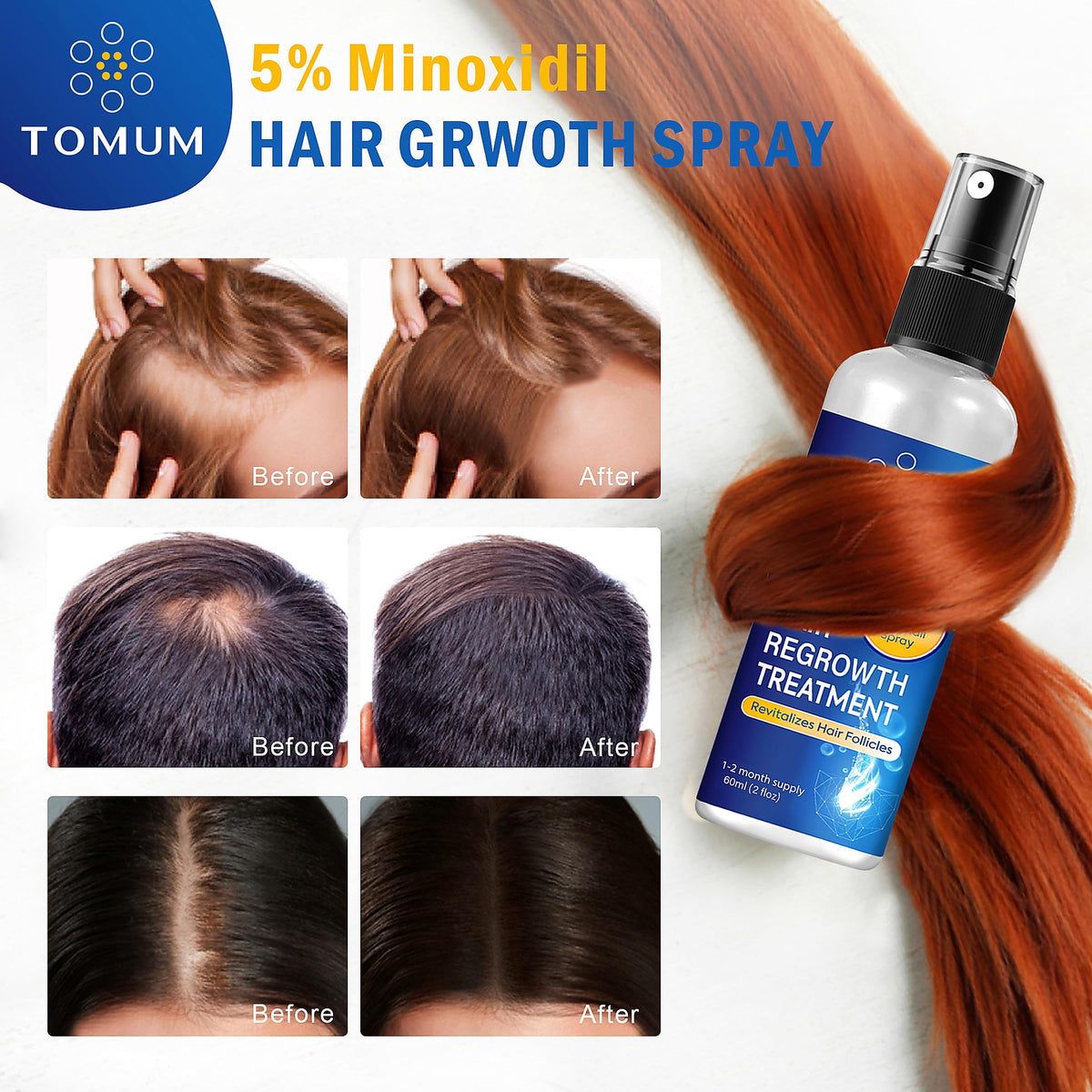 TOMUM Minoxidil 5% Hair Regrowth lifestyle scene