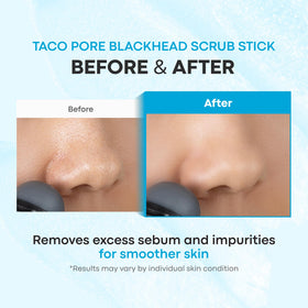 TONYMOLY Tako Pore Clay Scrub Stick with marine ingredients