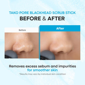 TONYMOLY Tako Pore Scrub Stick Duo on bathroom counter