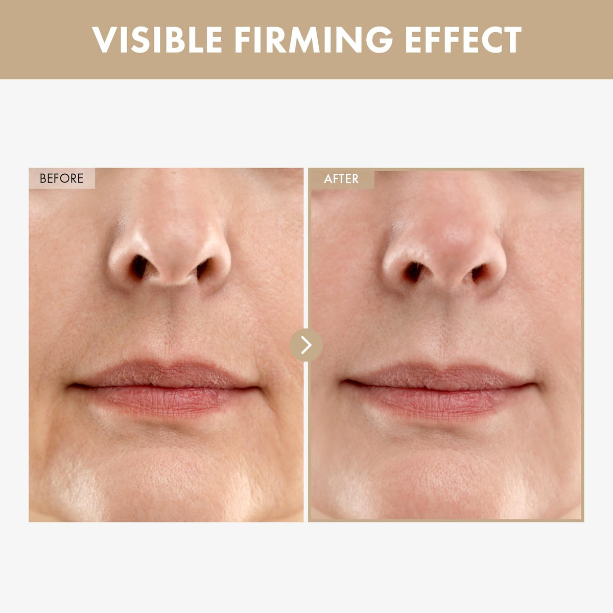 TOSOWOONG Carnosine Lifting Serum application on skin