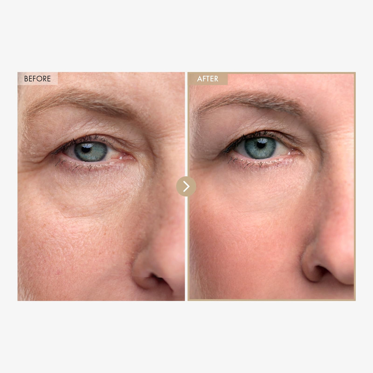 TOSOWOONG Carnosine Lifting Serum texture close-up
