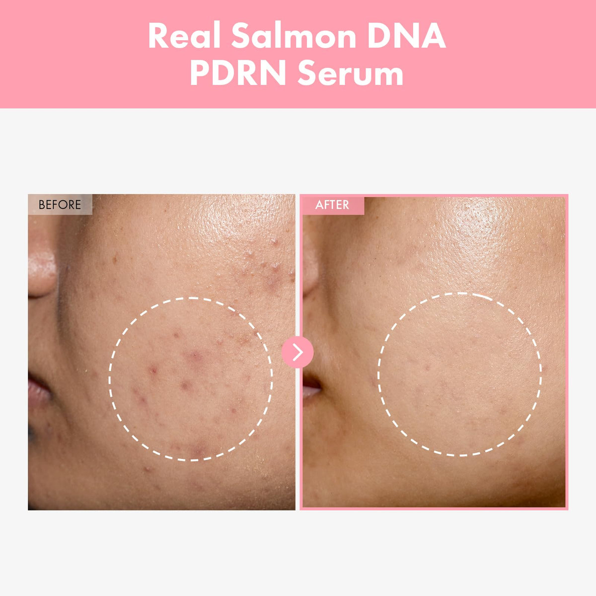 TOSOWOONG Pink Peptide 12 PDRN Serum bottle side view