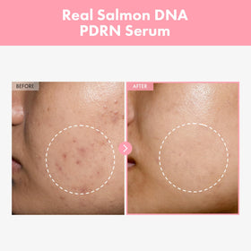 TOSOWOONG Pink Peptide 12 PDRN Serum bottle side view