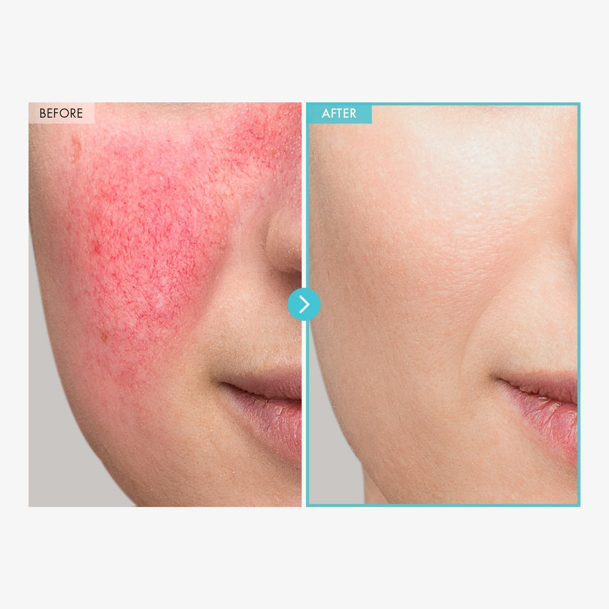 TOSOWOONG Zinc Oxide 10% Cream ingredients list