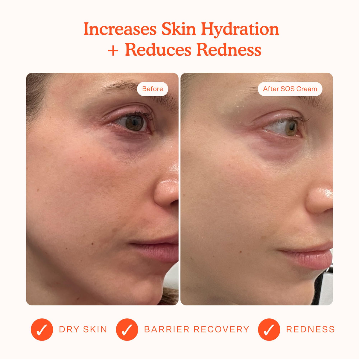 Tower 28 SOS Recovery Hydrating Face Cream side view