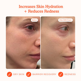 Tower 28 SOS Recovery Hydrating Face Cream side view