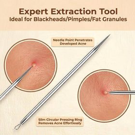 Travel case for DERMATED Pimple Popper Tool set