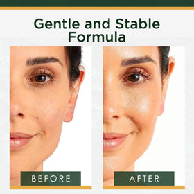 Tree of Life Vitamin C+ Serum 20% on a clean surface