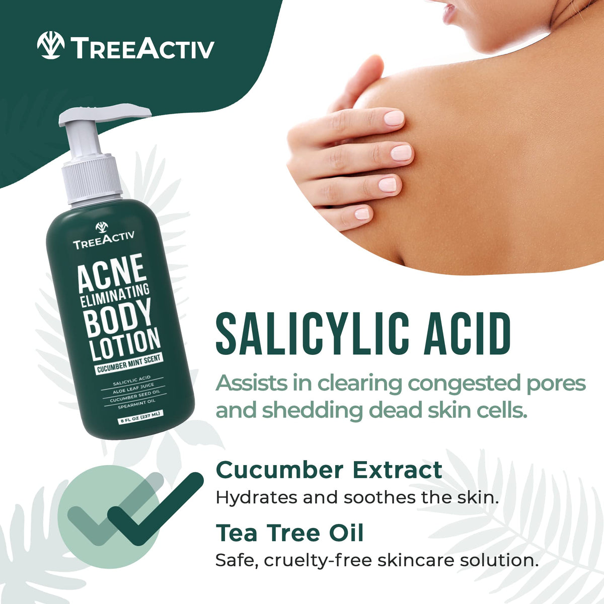 TreeActiv Acne Eliminating Body Lotion 8 fl oz application on skin