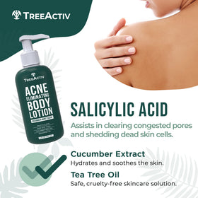 TreeActiv Acne Eliminating Body Lotion 8 fl oz application on skin