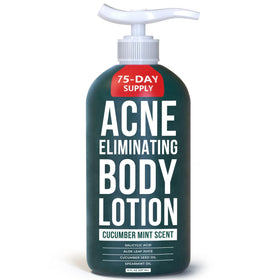 TreeActiv Acne Eliminating Body Lotion 8 fl oz front view